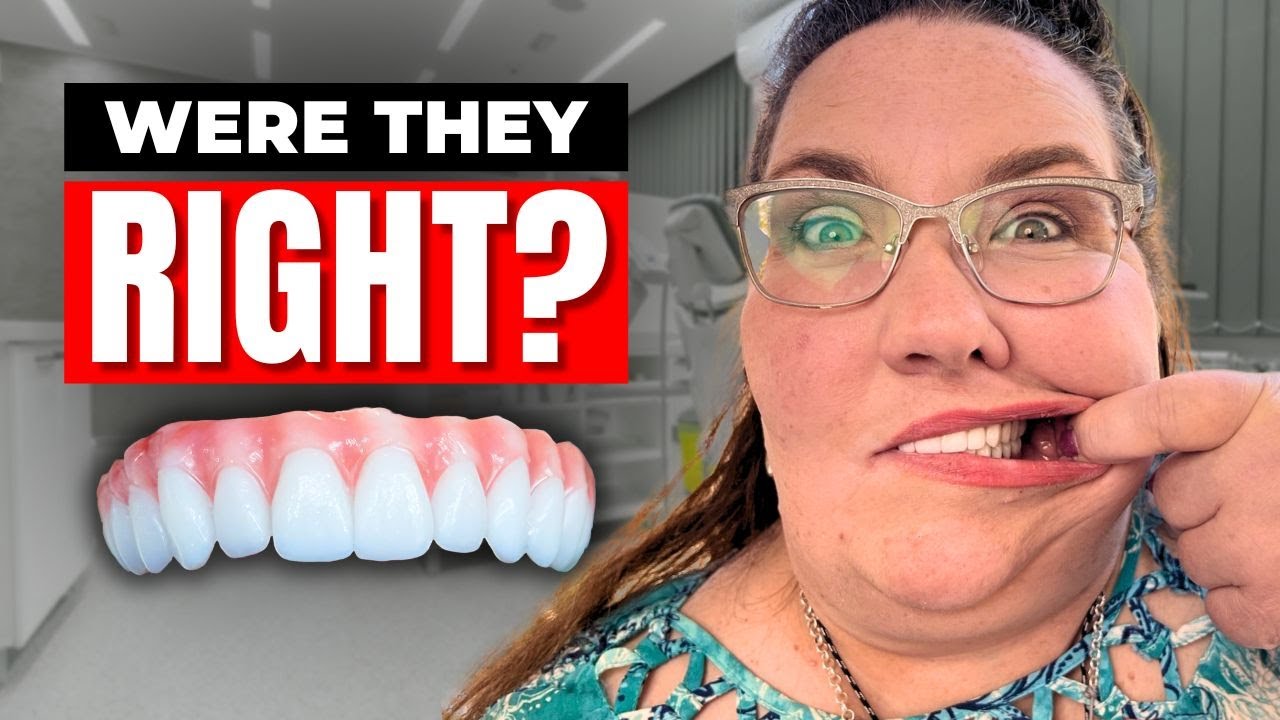 10 Reasons They Told Me NOT to Get 24-Hour Dental Implants