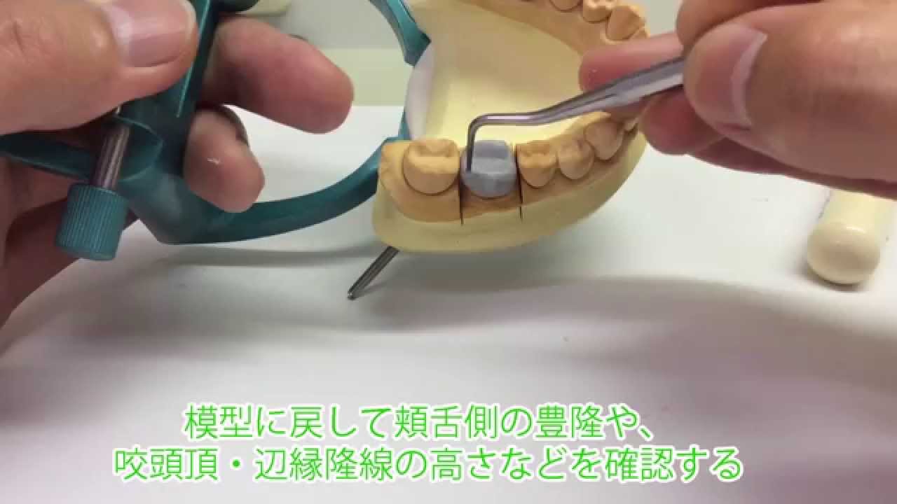 冠橋義歯補綴学１実習（ろう型形成）