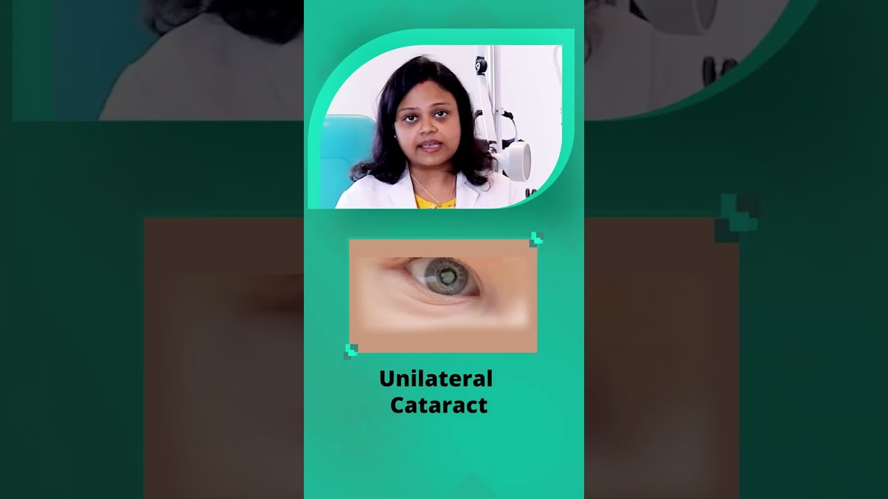 Can children develop Cataract? | Know more about Cataract in children | Pediatric Cataract #shorts