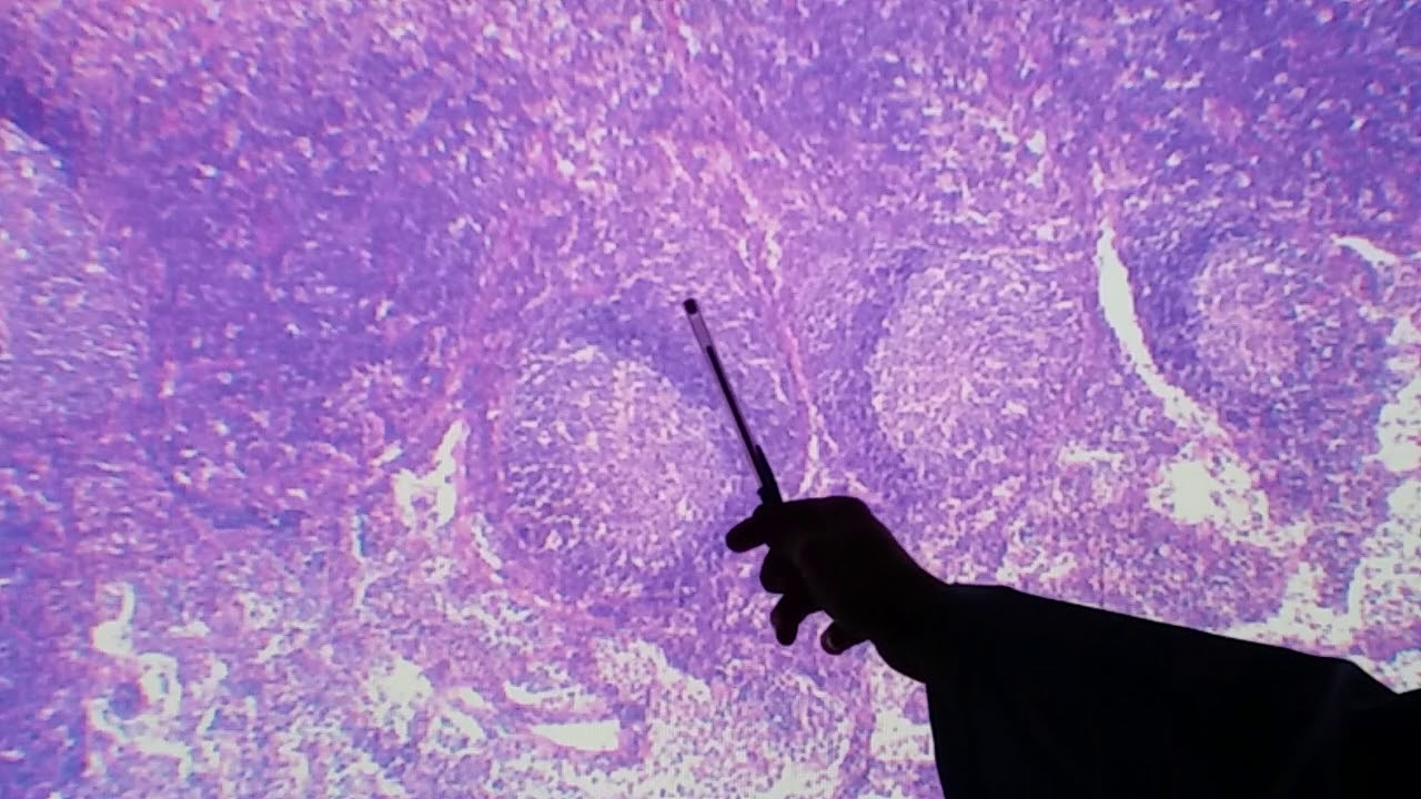 Histologia do linfonodo