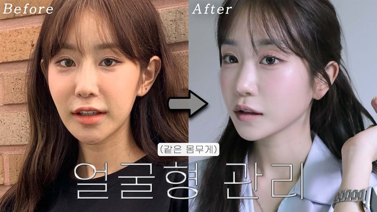 얼굴에 뭐했냐구요?💁🏻‍♀️ 나의 4년간의 노하우가 담긴... 얼굴형 관리 추천/비추천 시술 모음📦 l 시술 실패하지 않는 방법까지♥︎ㅣ얼굴형 예뻐지는 법ㅣ여신티켓