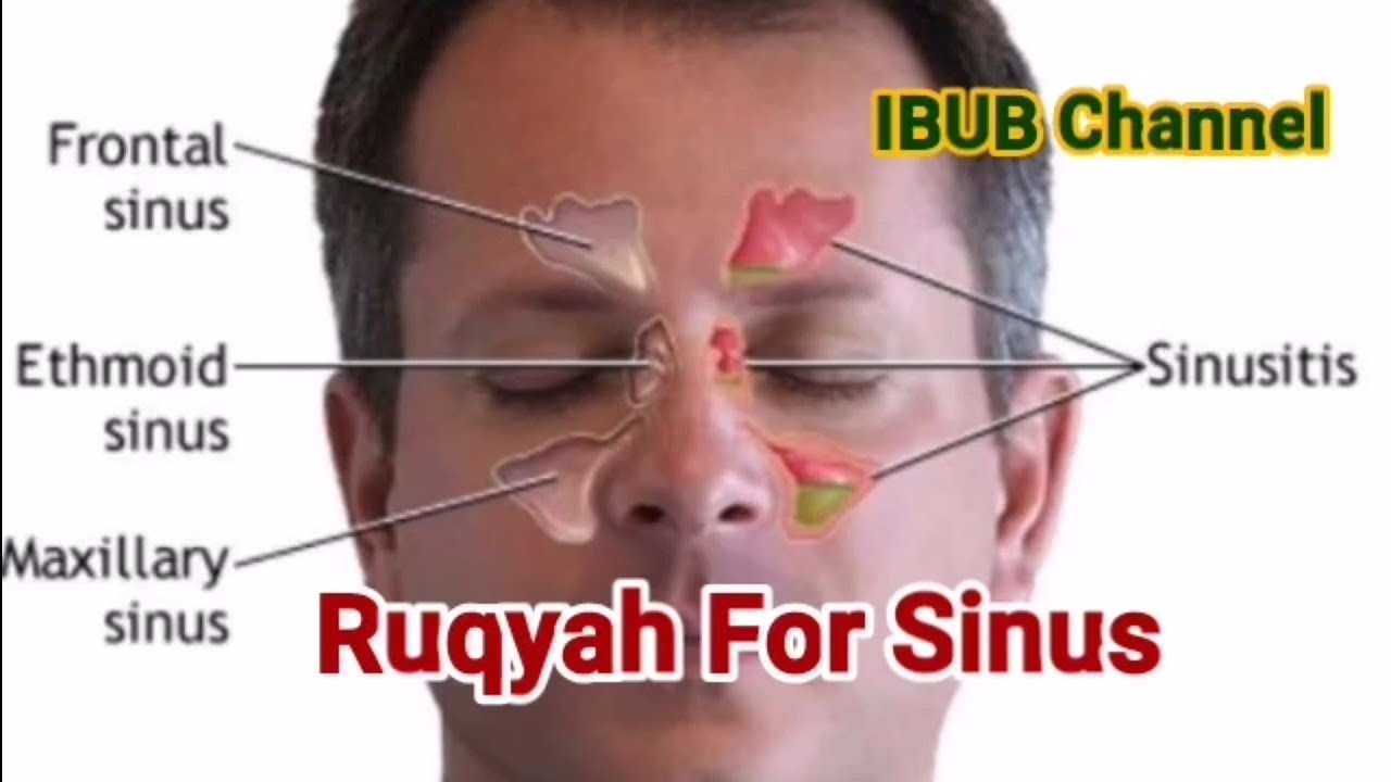 Ruqyah For Sinus