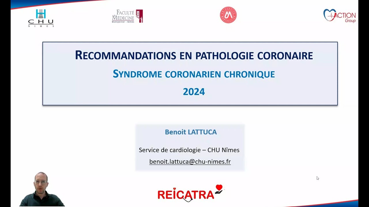 Syndrome coronarien chronique - Recommandations 2024 - Benoit Lattuca