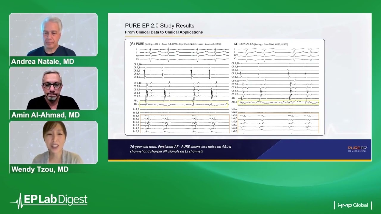 PURE EP 2.0 Study Results, From Clinical Data to Clinical Applications (A Physician Roundtable)