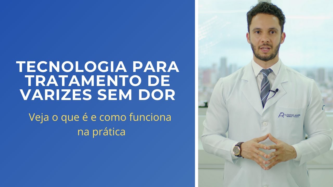 Tratamento de varizes sem dor : conhe&ccedil;a essa tecnologia.