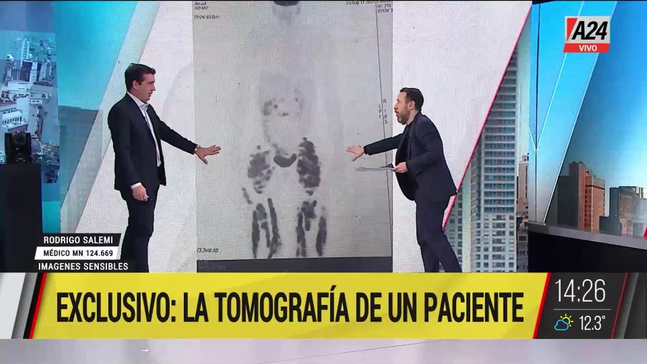 🔴 EXCLUSIVO: la tomografía de un paciente de Aníbal Lotocki