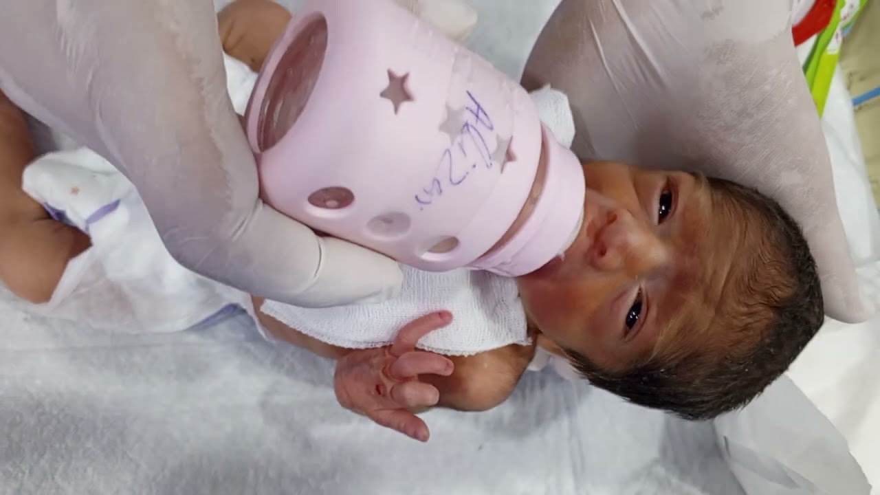 Part 3 Preterm Baby Feeding Step-by-Step Feeding Protocol in NICU & Initial Assessment