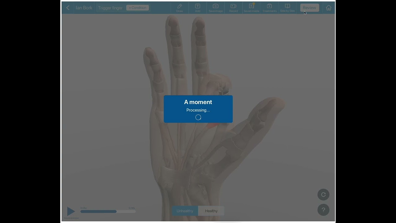 Always Health Demo - Patient Understanding Platform