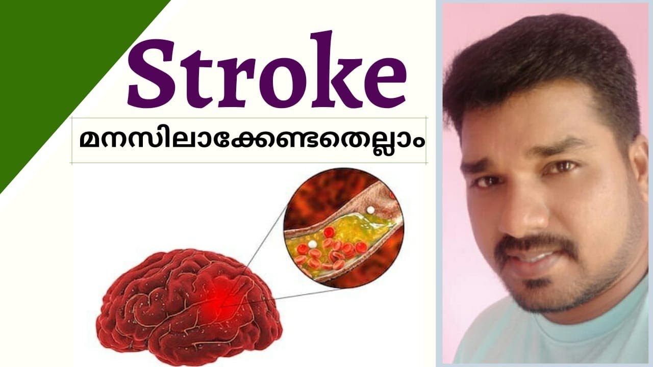 Stroke- Causes, Symptoms & Management Explained in Malayalam