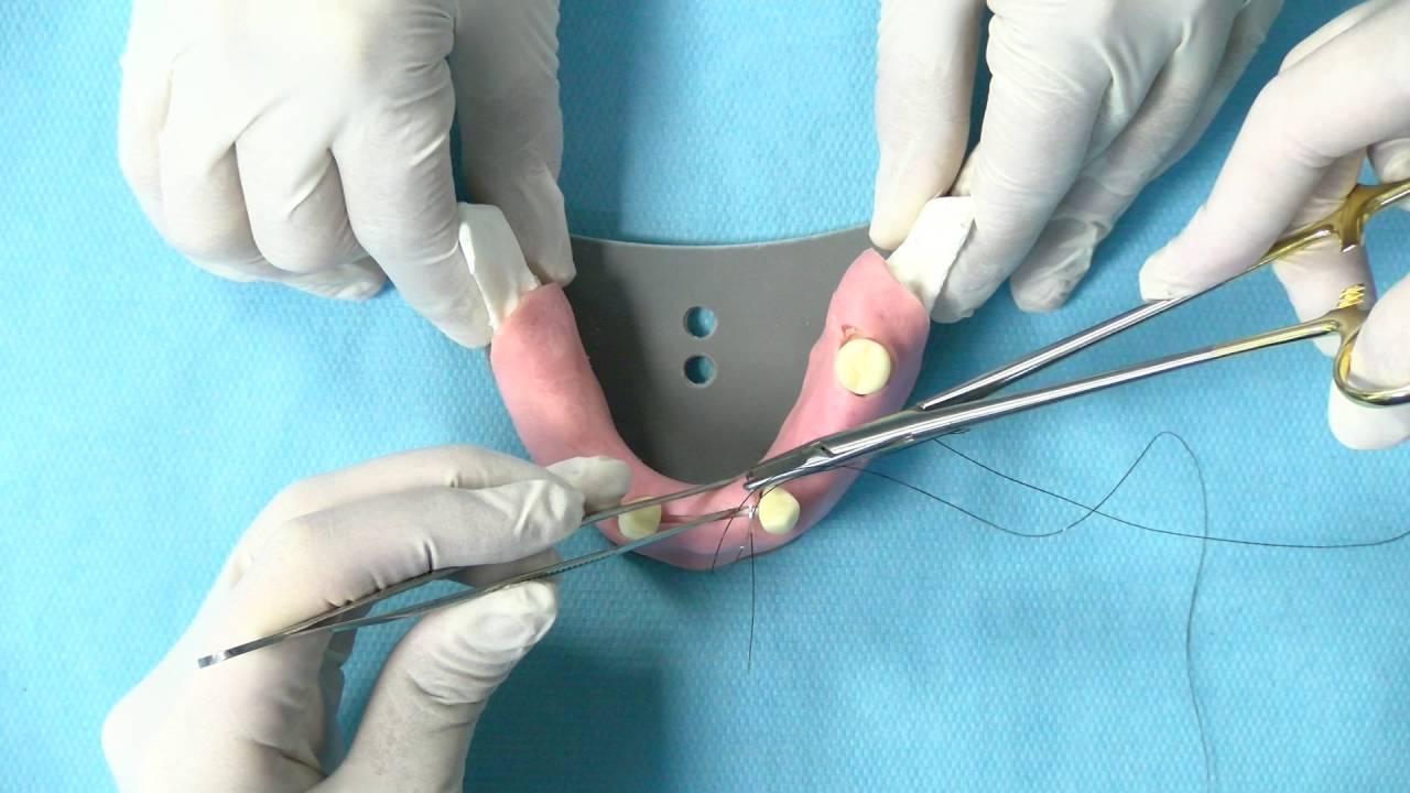 Sutura- implantología oral