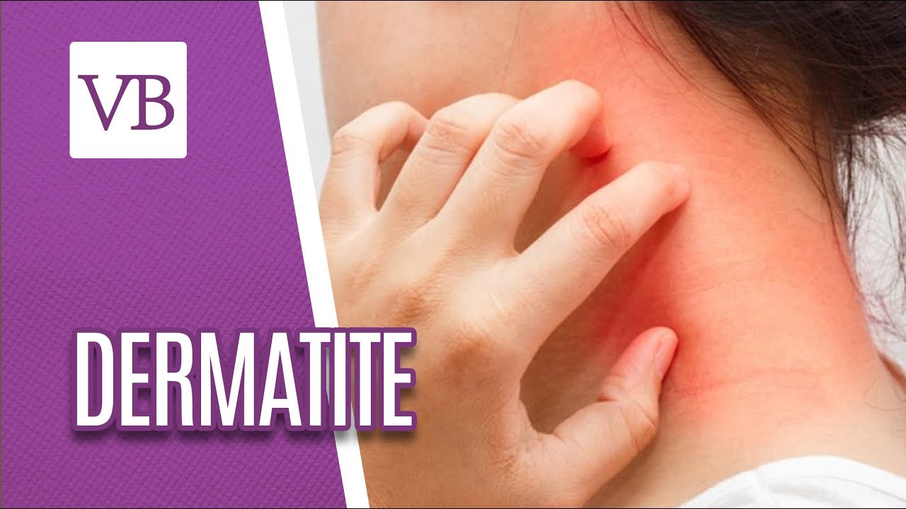Dermatite - Você Bonita (07/11/18)