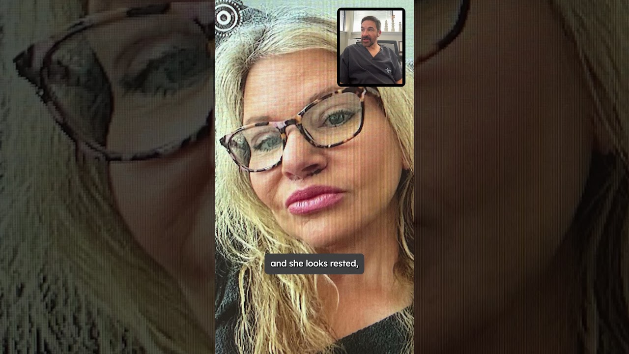 Facelift Under Local Anesthesia Before and After | Face Lift Plastic Surgeon