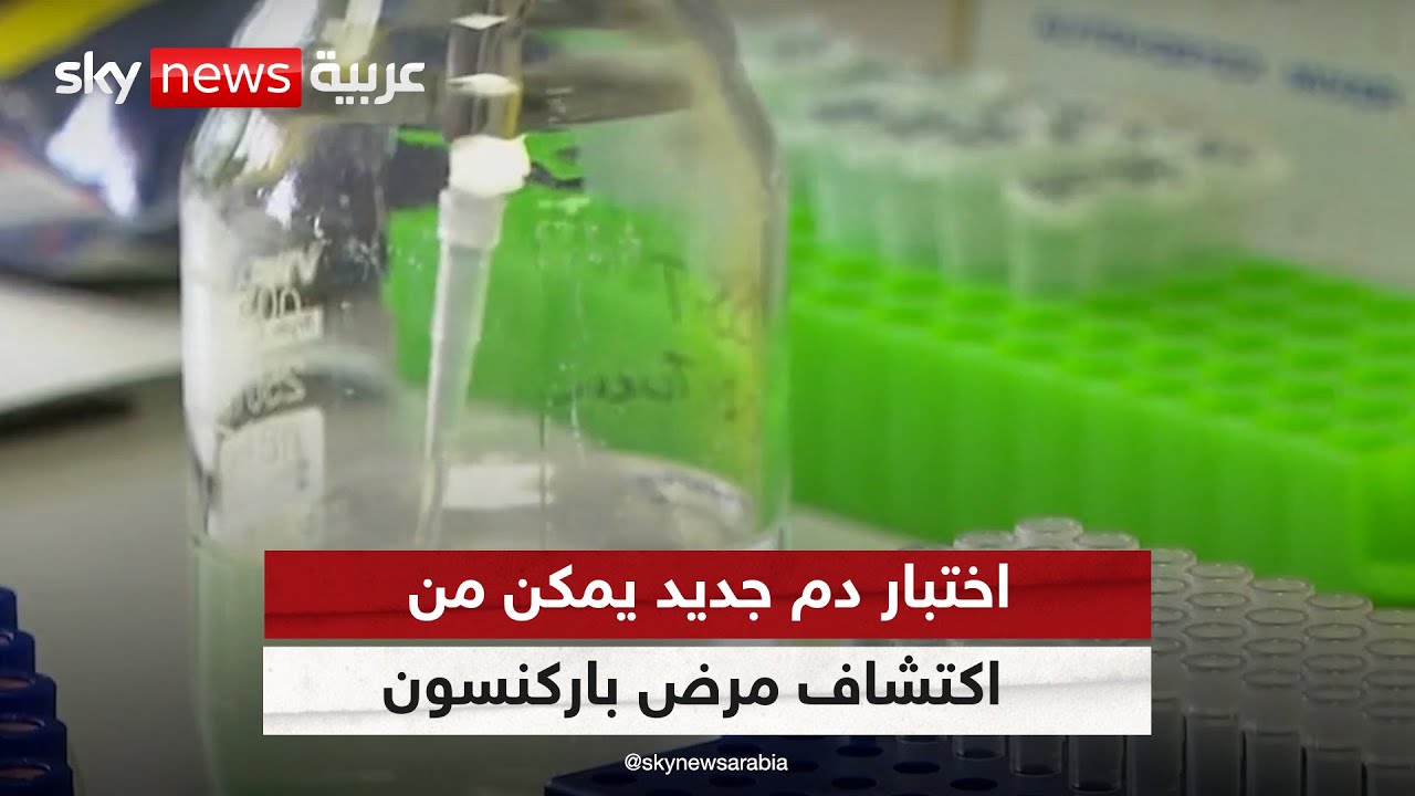 اختبار دم جديد يعتمد الذكاء الاصطناعي يمكن من اكتشاف مرض باركنسون بشكل مبكر