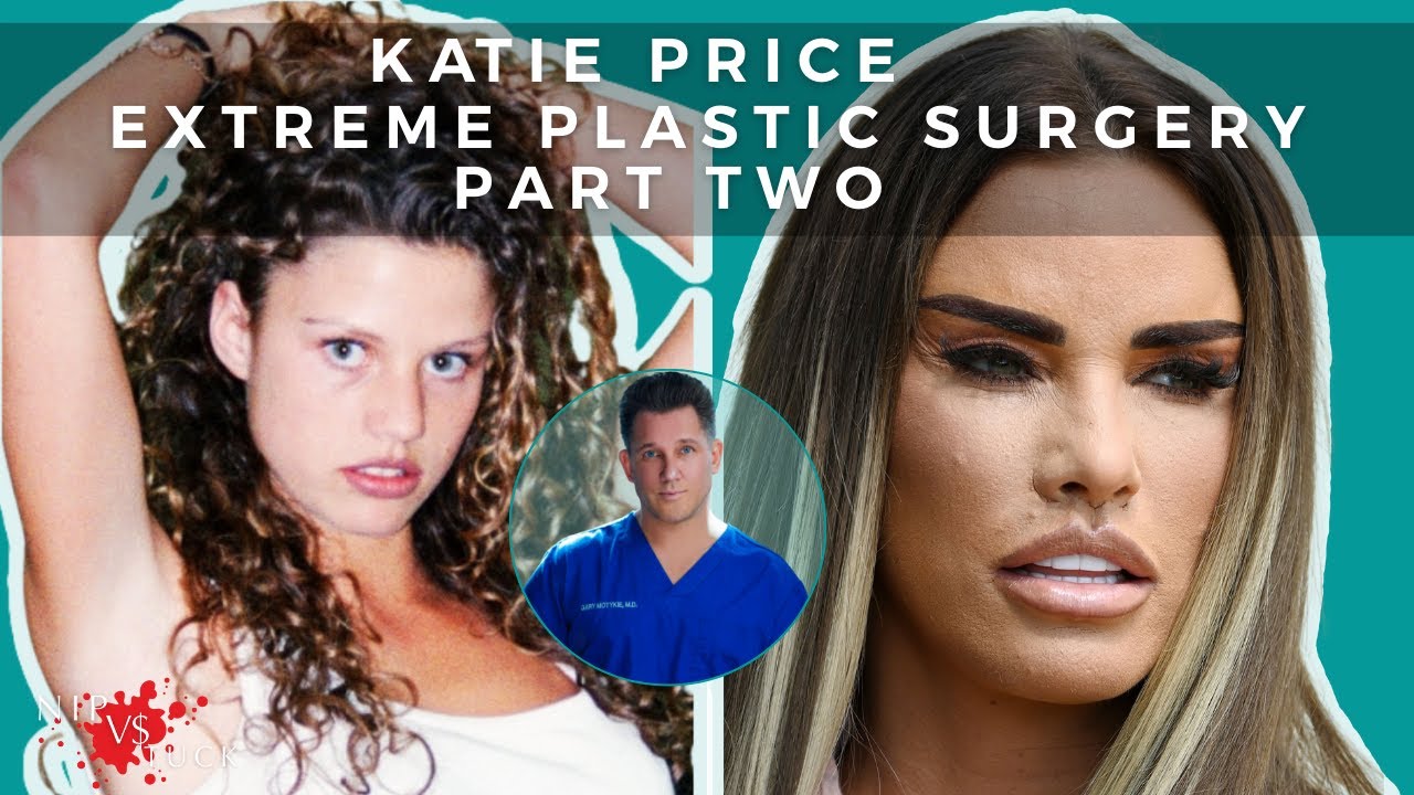 Plastic Surgeon Discusses Body Dysmorphia: Katie Price Part 2