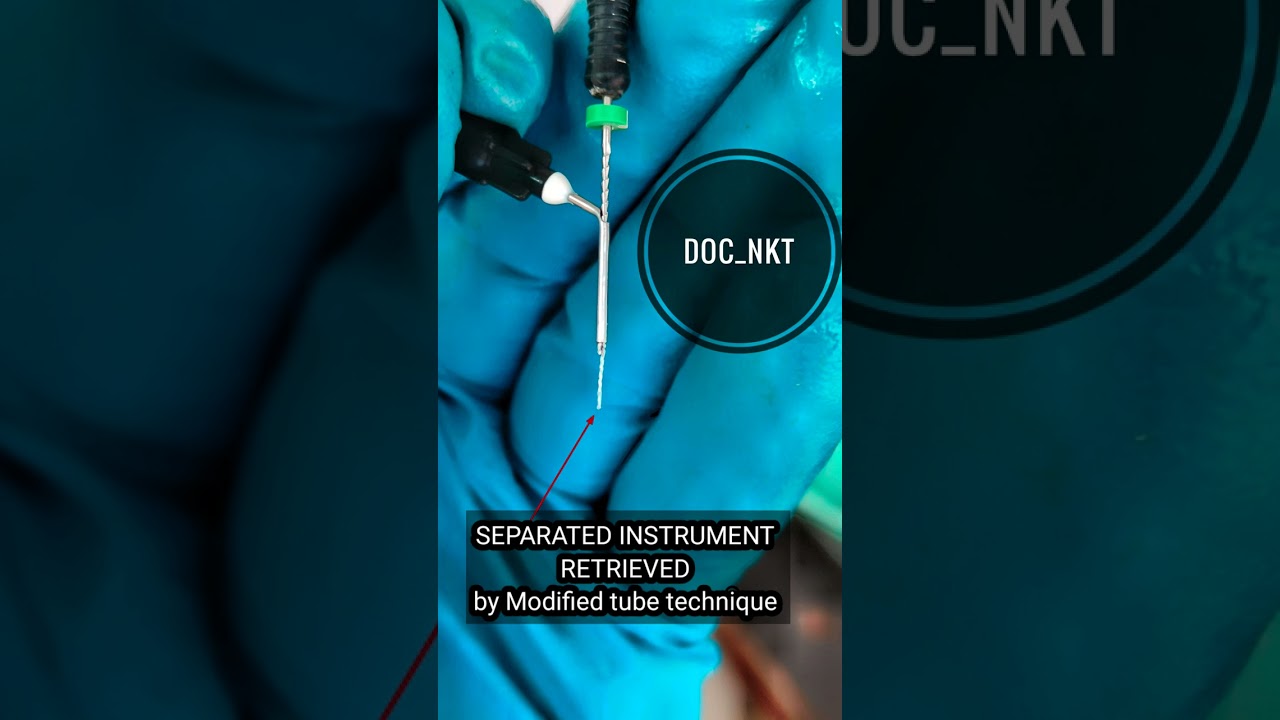 How Broken File Retrieved || Modified tube technique #shorts