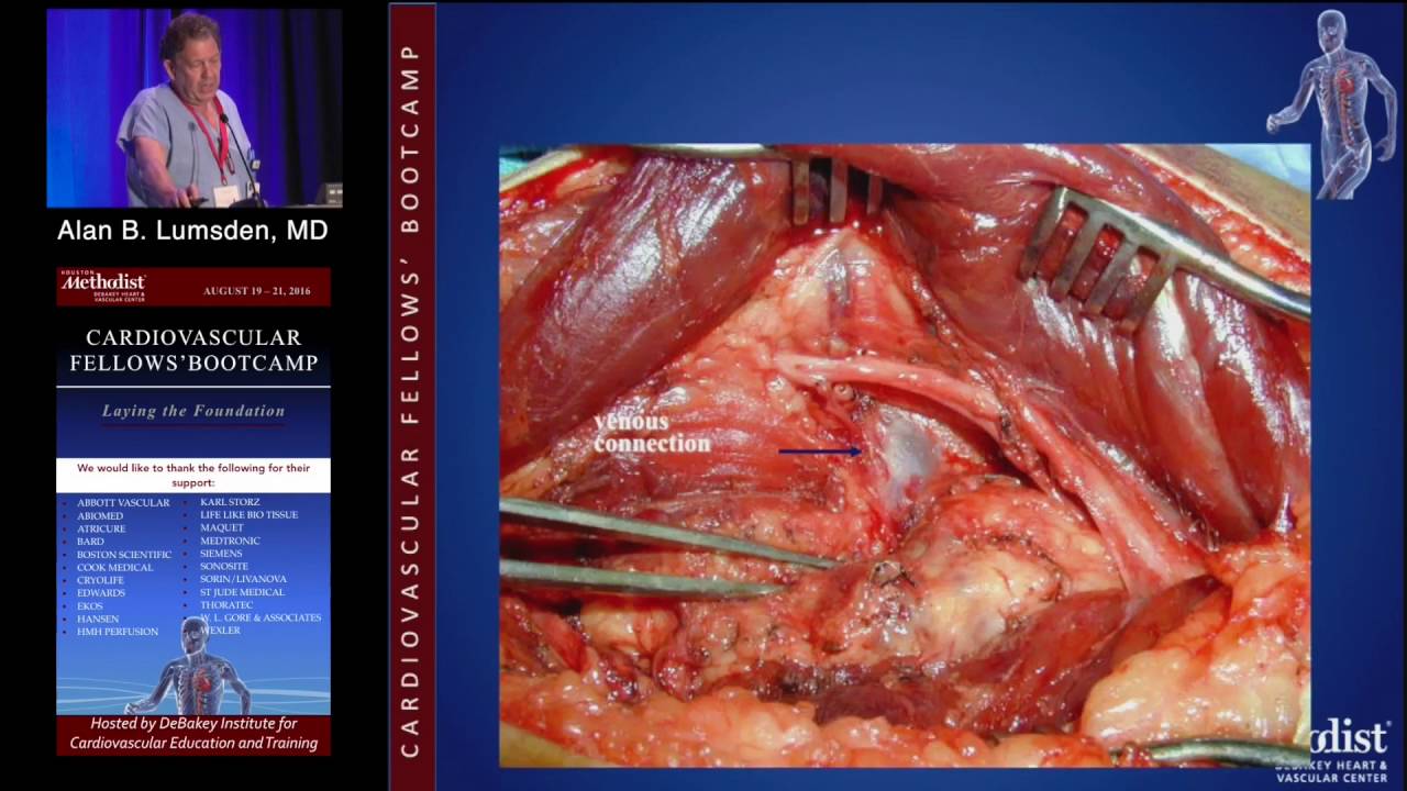 Diagnosis and Management of AVMs ( Alan B. Lumsden, MD) Saturday, August 20, 2016