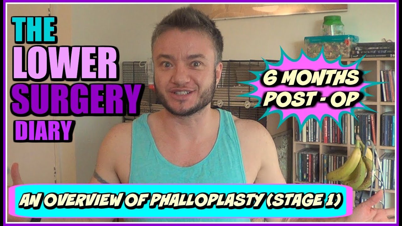 FTM phalloplasty lower surgery overview ( stage 1)