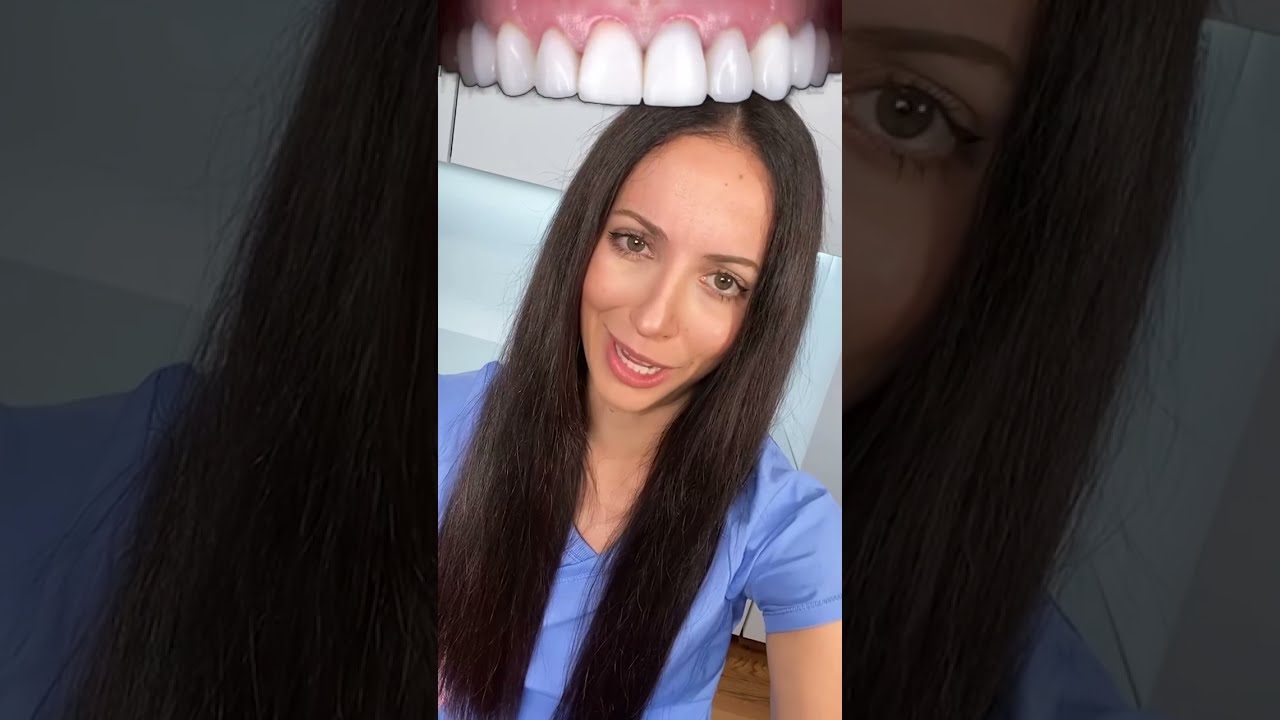 crowns vs veneers #shorts