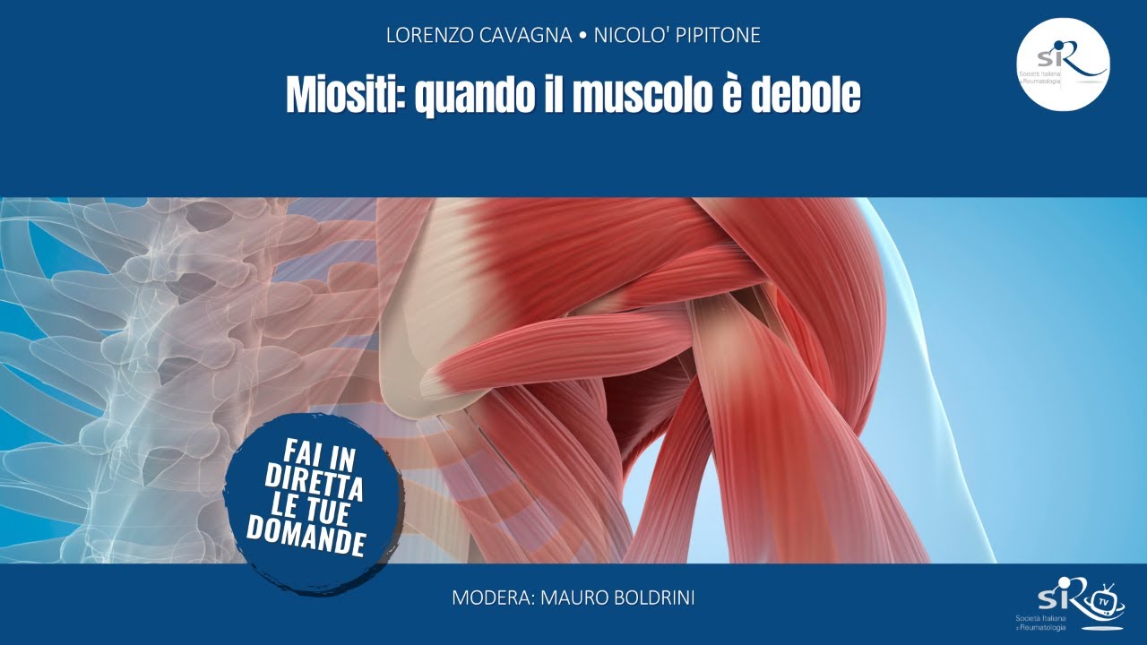 Miositi: quando il muscolo è debole