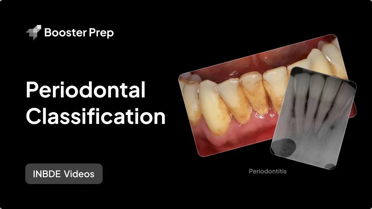 Periodontics | Periodontal Classification | INBDE, NDEB, ADAT