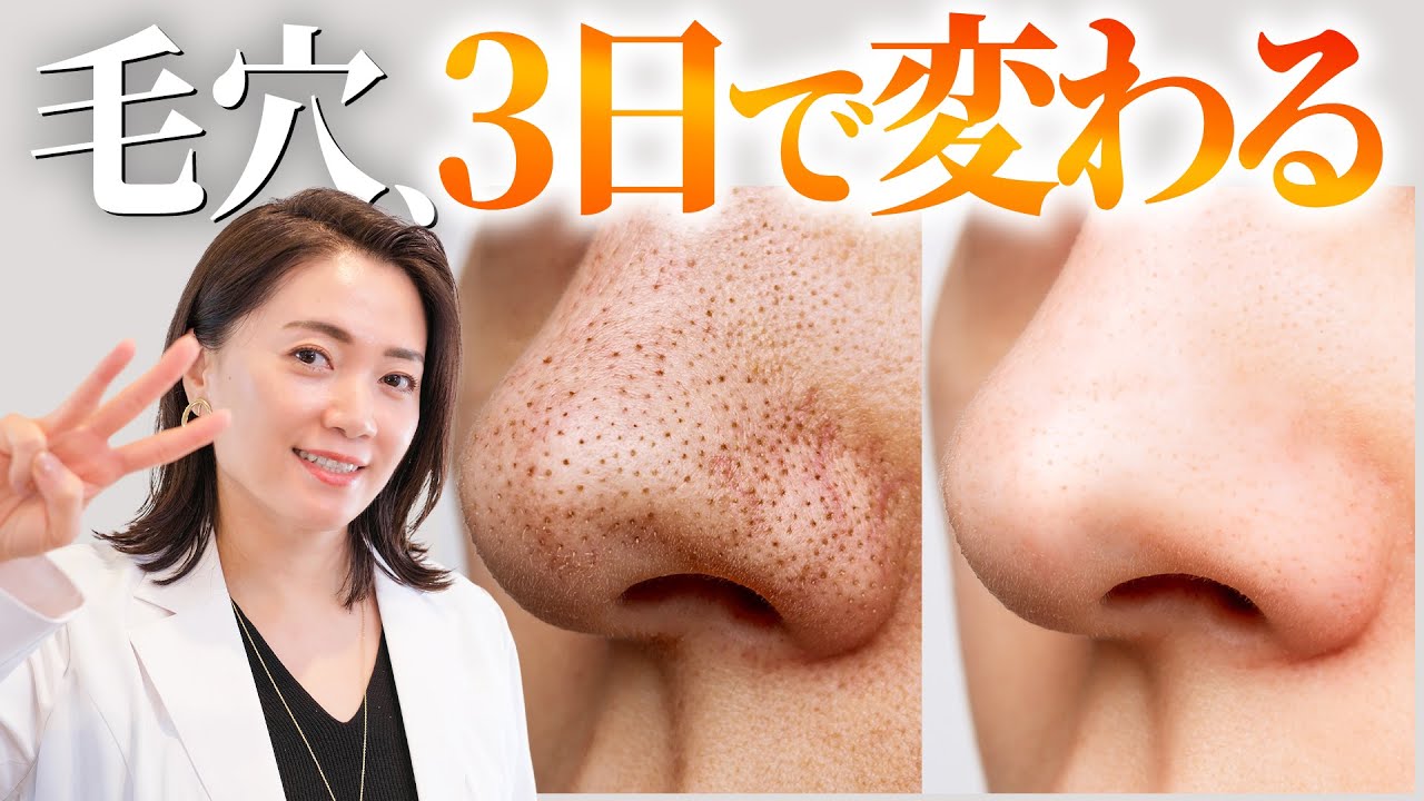 【毛穴解消】9割がやってない「3日で毛穴を変える」方法