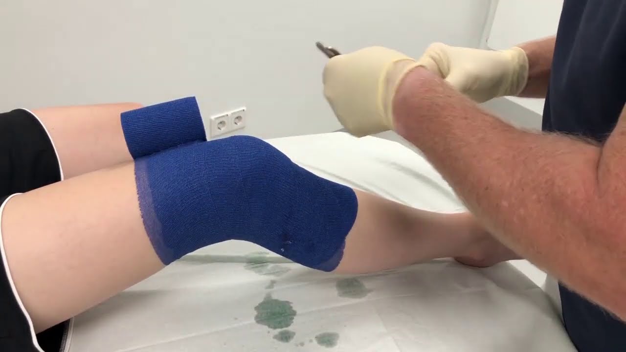 Stütz- Kompressions- und Fixierverband Kniegelenk