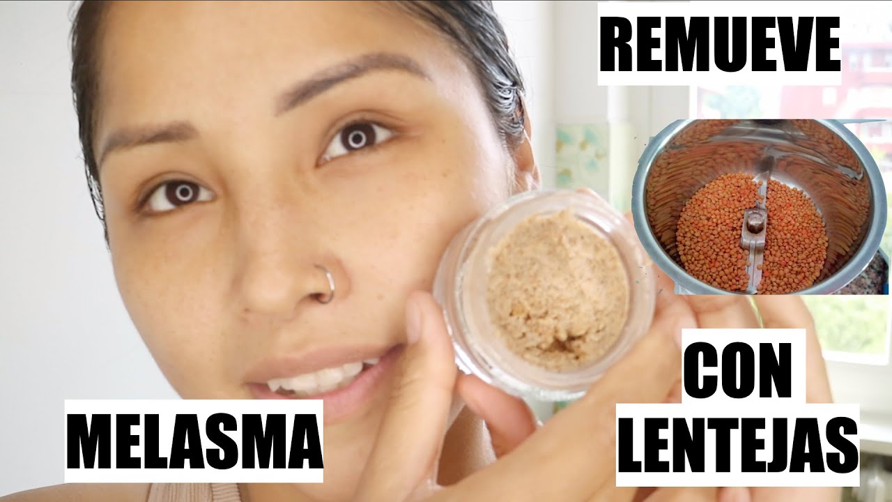 EN 10 DIAS ELIMINA MELASMA | PAÑOS Y MANCHAS DE TU CARA! Maya Belleza de la India