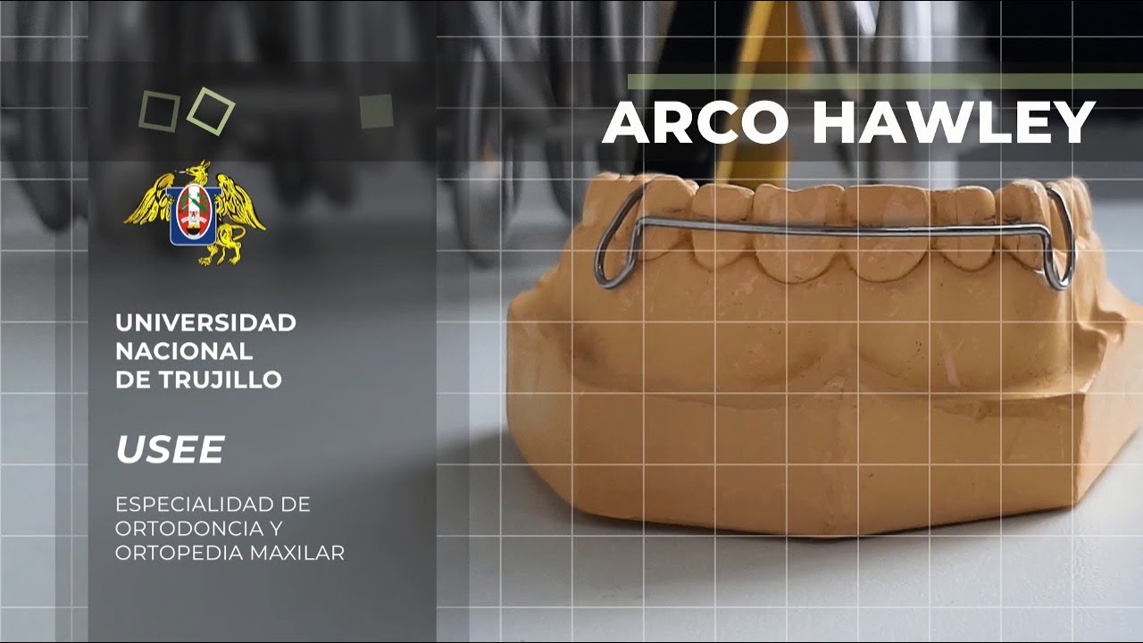 CONFECCIÓN ARCO HAWLEY