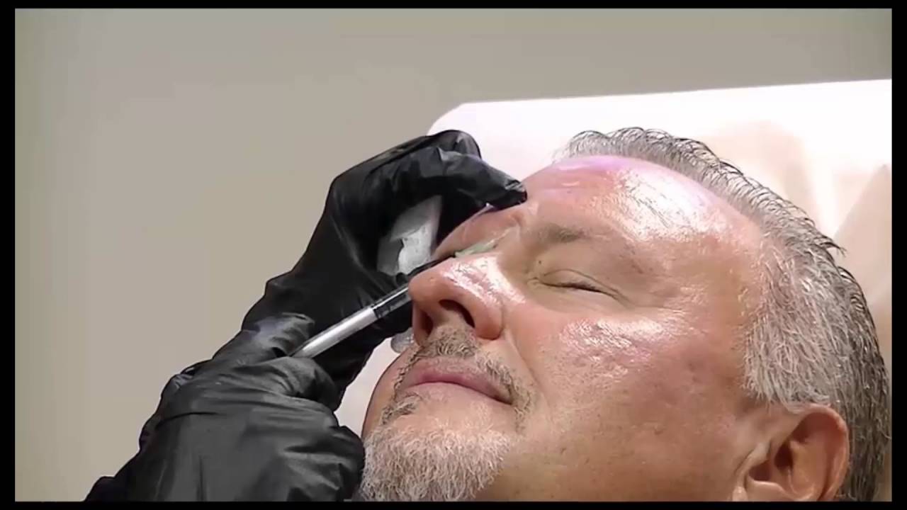 Botox for Men in West Palm Beach, Florida