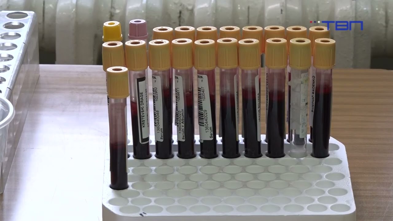 Trista pacijenata dnevno uradi laboratorijske analize - TV Pančevo