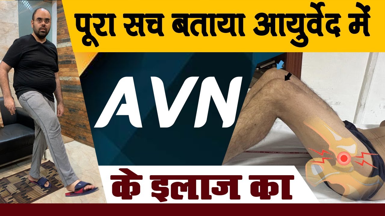 क्या आयुर्वेदा ही सही है AVN Treatment के लिए? जानिये सारे जवाब पेशेंट से |Dr Avinash Singh Chauhan