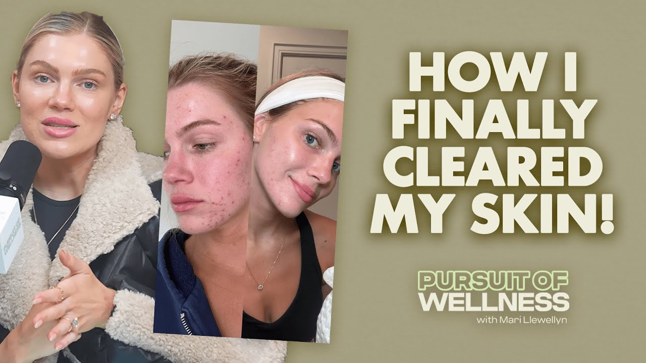 How I Finally Cleared My Skin: Acne, Aging & Inflammation Hacks from Top Experts