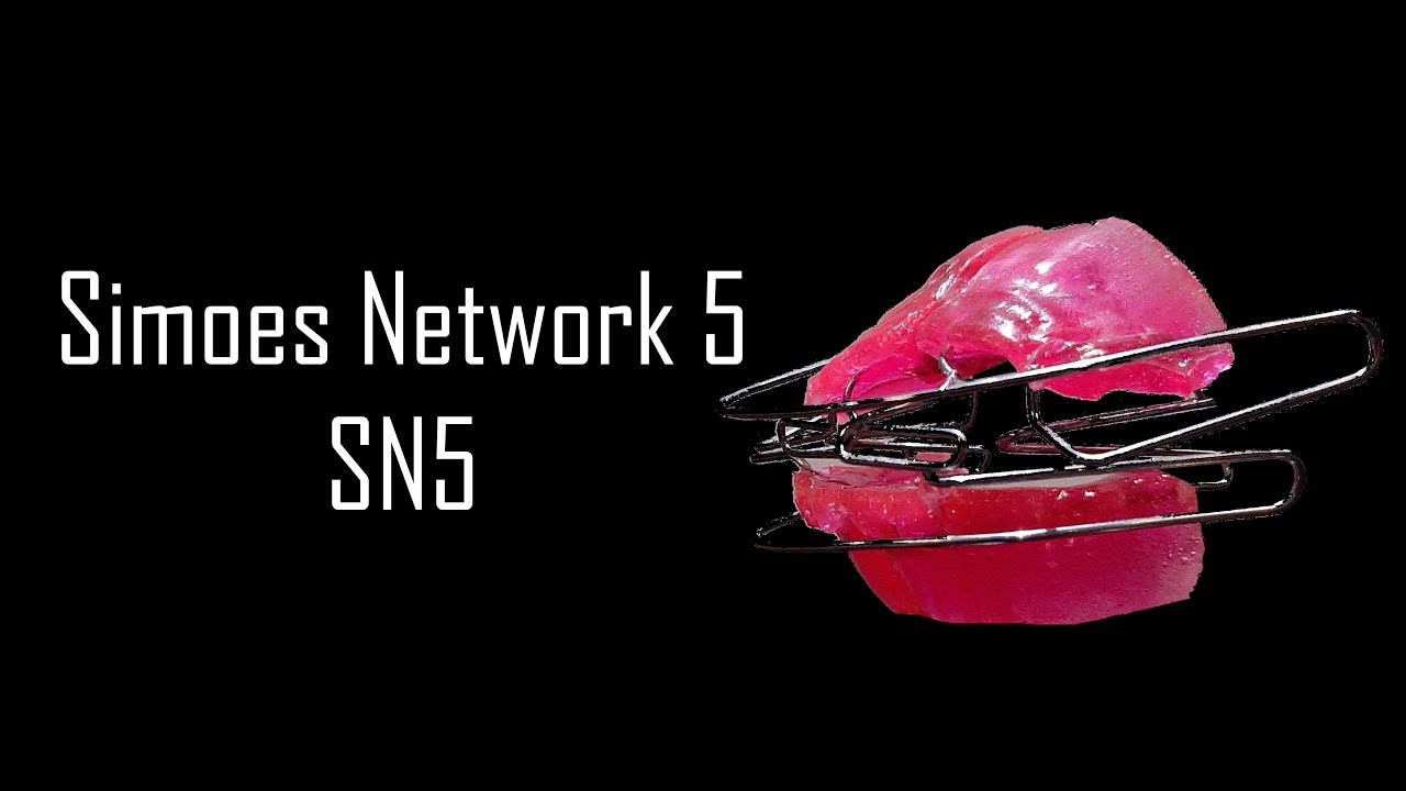 Elaboraci&oacute;n de SN5 Simoes Network 5 | Elena Dental Art & More