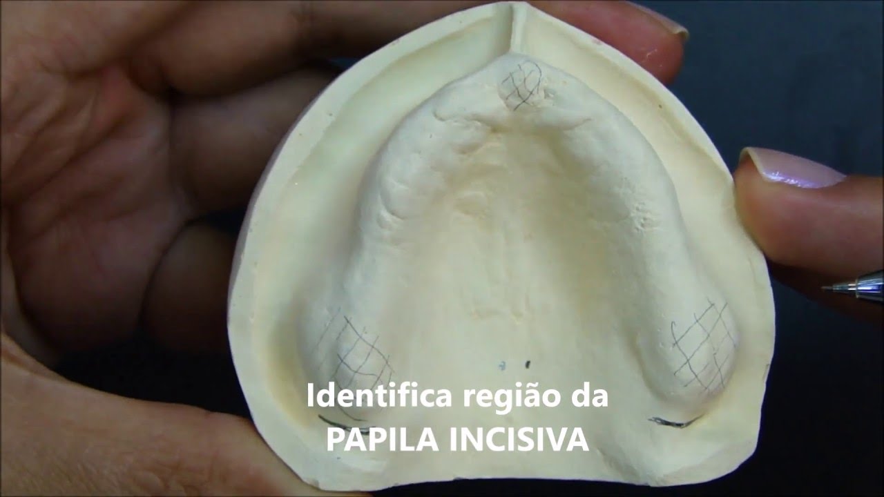 Delimitação da área basal da maxila
