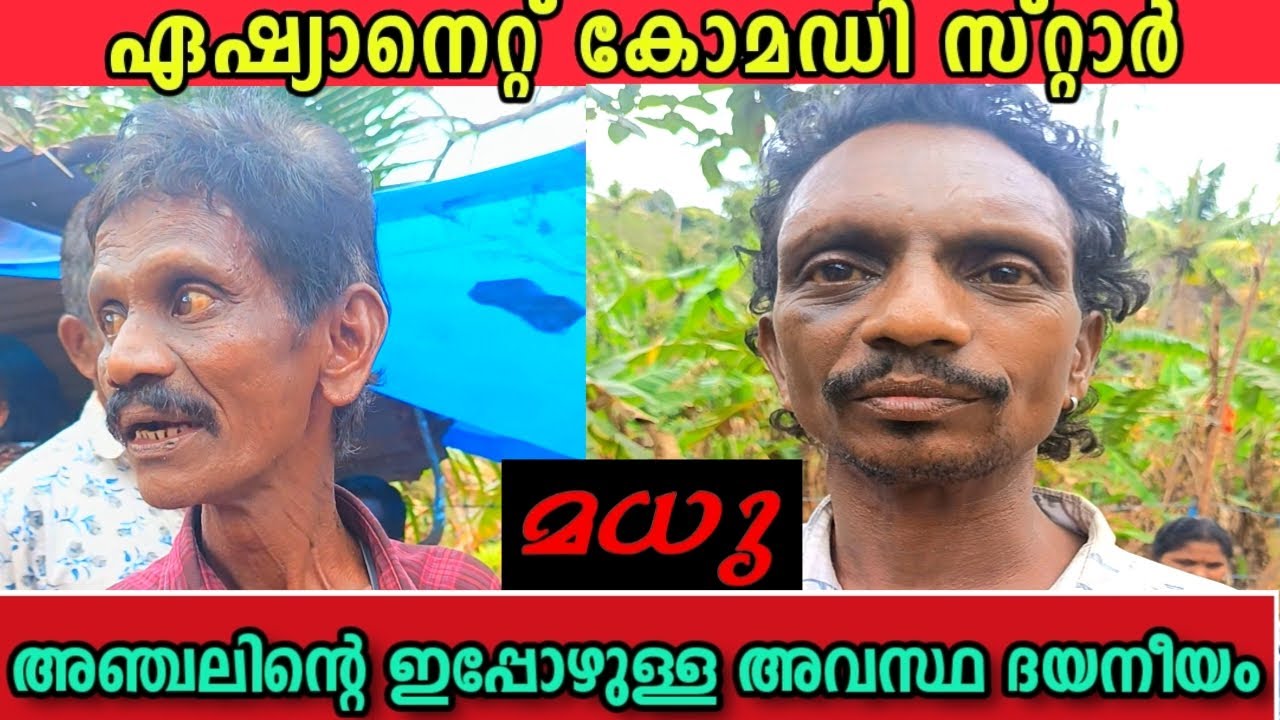ഏഷ്യാനെറ്റ്‌ കോമഡി താരം മധു അഞ്ചലിന്റെ അവസ്ഥ | Is there no one to save this artist?| ആരാണ് മധു അഞ്ചൽ