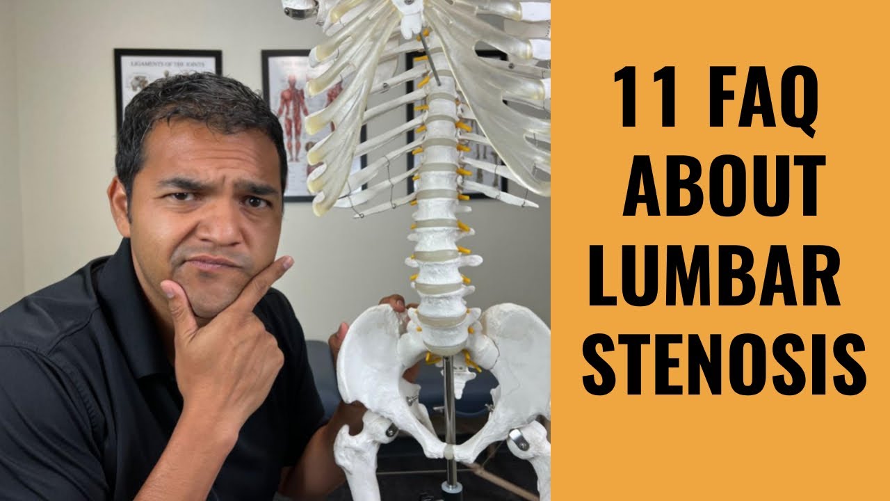 11 Most Frequently Asked Questions About Lumbar Spinal Stenosis