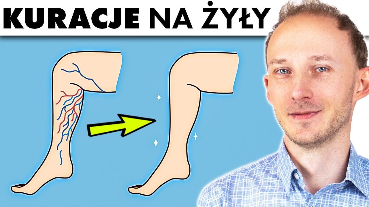 Odmłodzą żyły, cofną żylaki i poprawią krążenie | Dr Bartek Kulczyński