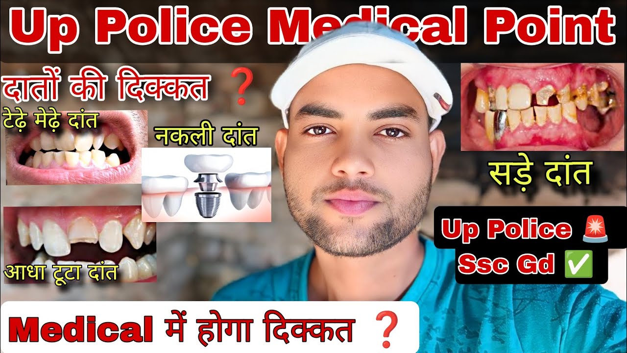 Medical में दांतों की दिक्कत❓ | Up Police Medical Point | Up Police Result Update | Up Police Result