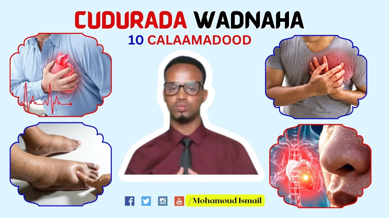 Cudurada Wadnaha Ku Dhaca | 10 Calaamadood