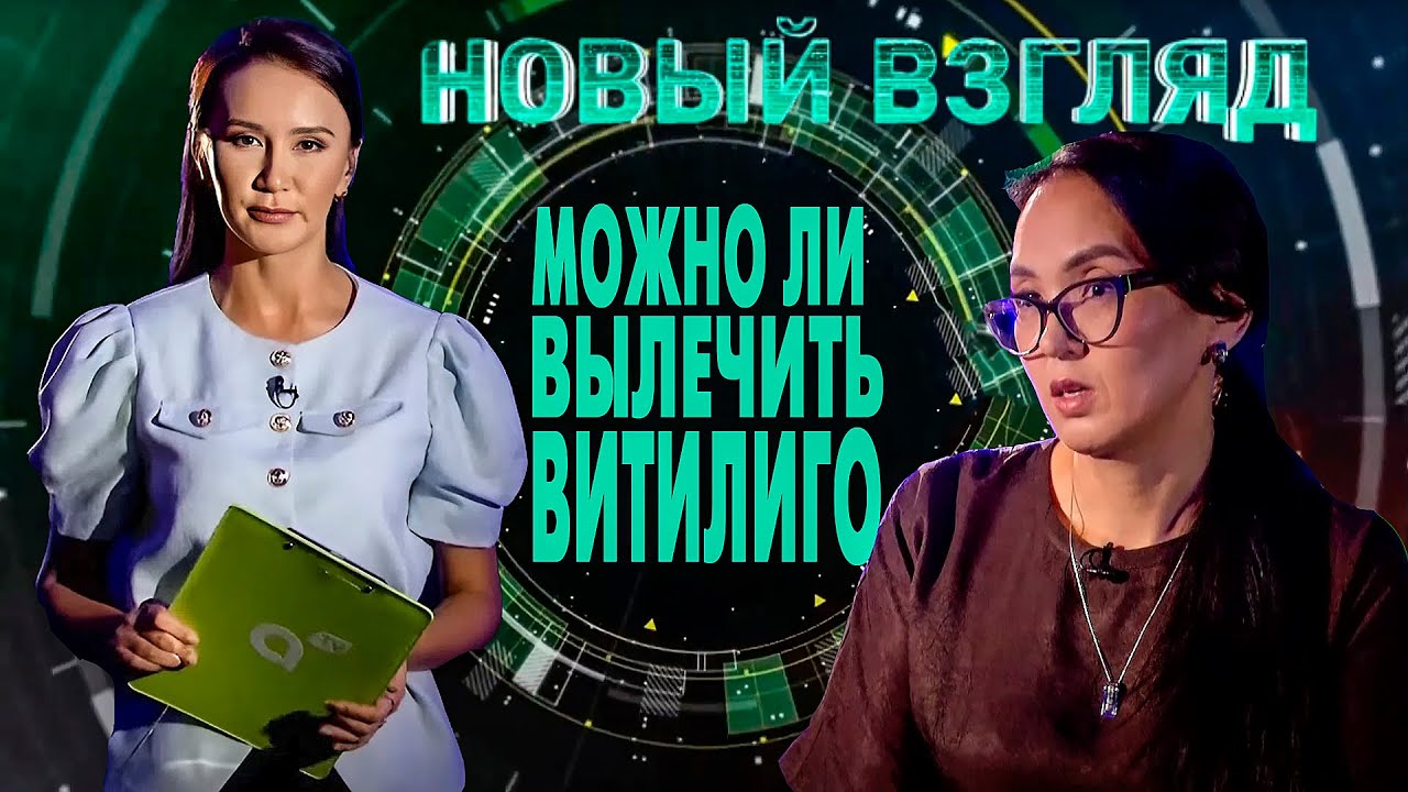 Новый взгляд: можно ли вылечить витилиго?