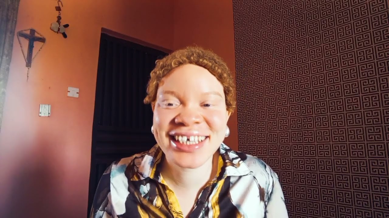 Debunking 3 Common Myths About Albinism + Skin care tips for People Living with Albinism.