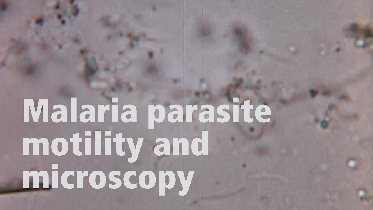 Jake Baum on the motility of malaria parasites