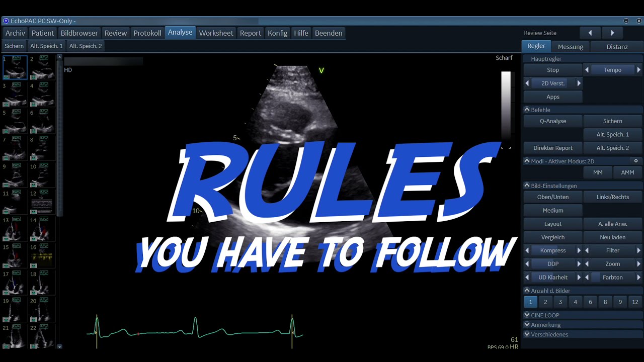 〖Echocardiography〗 Strain Imaging 1 - Basic Rules of Strain Imaging