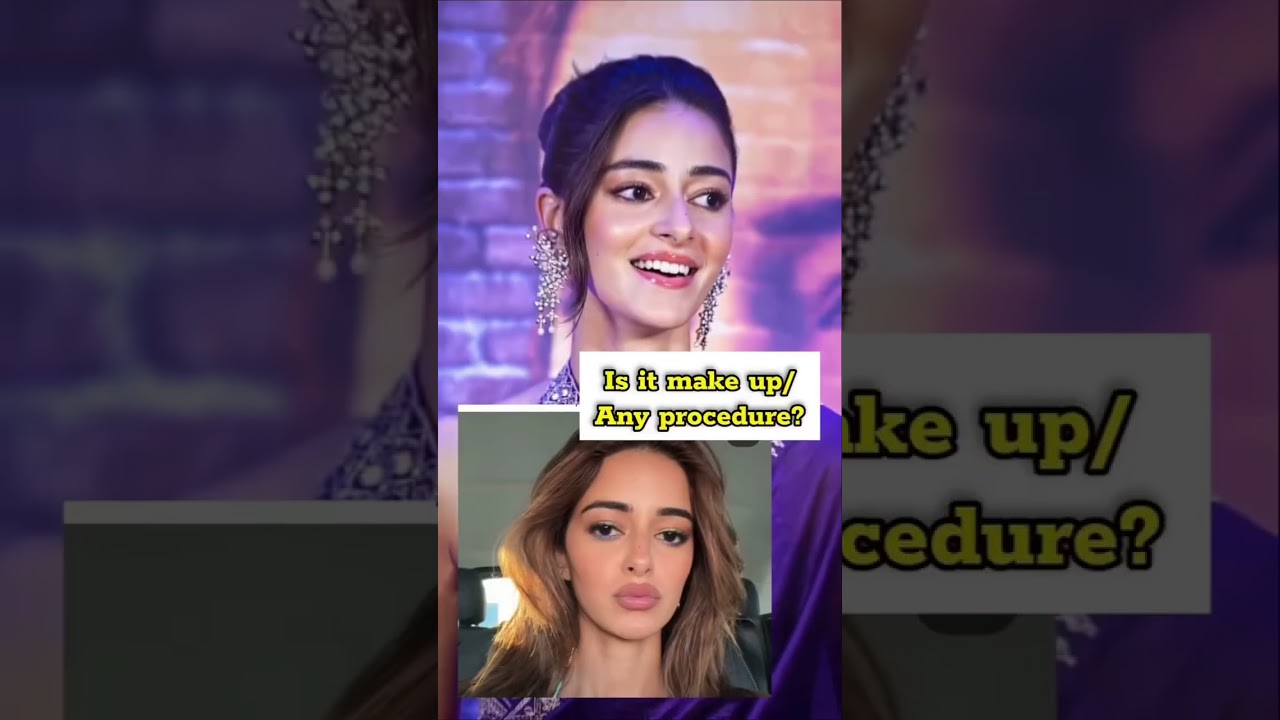 Did Ananya Pandey do something with her lips? Lip filler? jawline augmentation #cosmeticsurgery