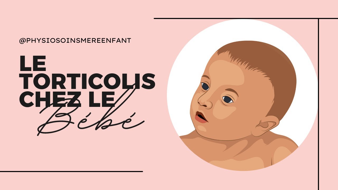 Torticolis chez le bébé