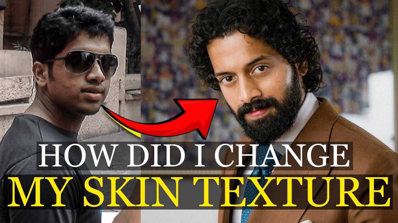 🚨How did I transform my skin❓️! 20 lifestyle  habits I followed!
