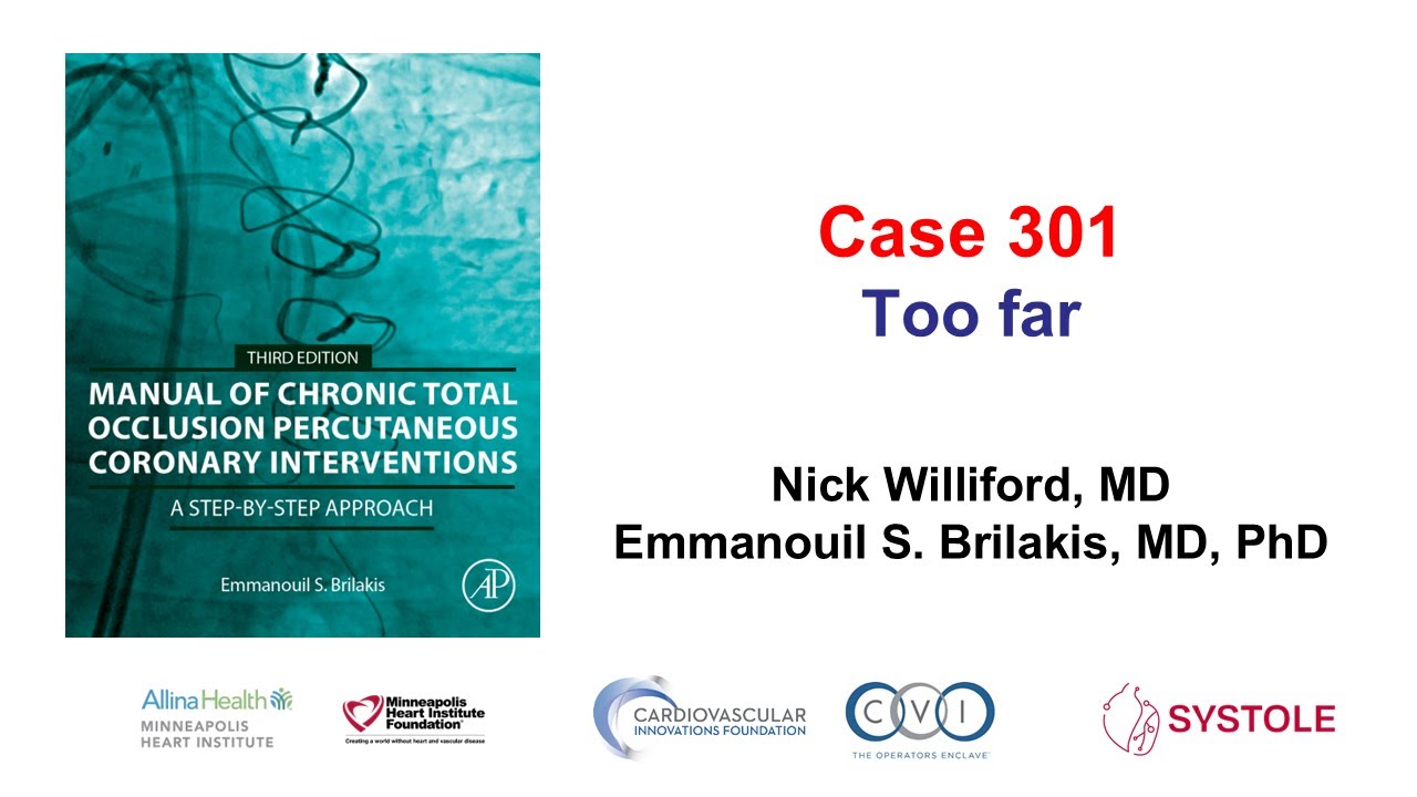 Case 301: Manual of CTO PCI -  Too far