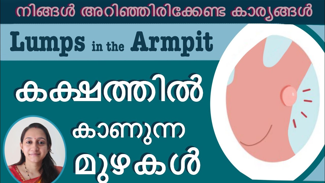 Lumps in the armpit #armpit_lumps