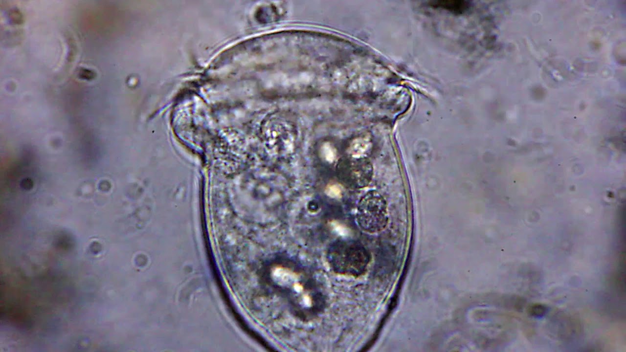 Vorticella