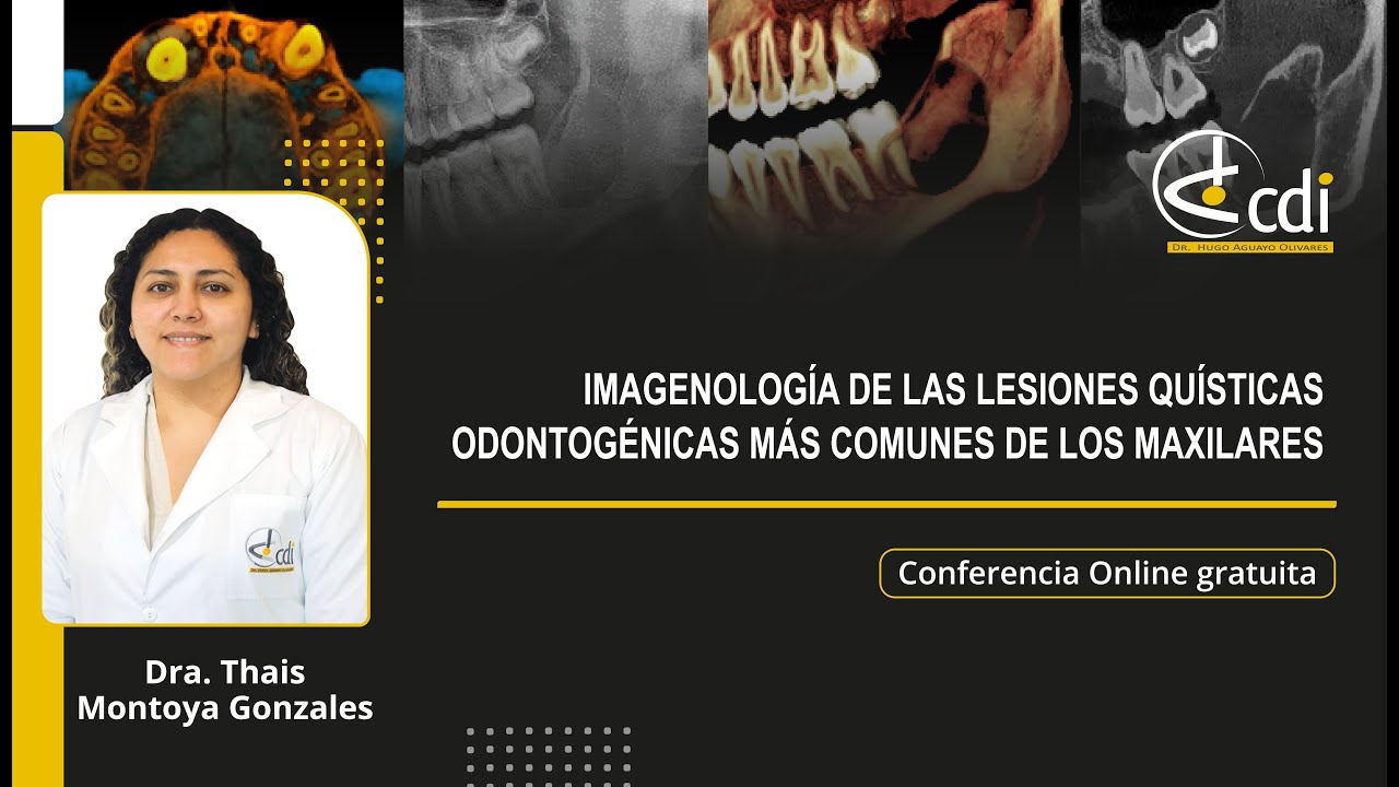 Conferencia Online IMAGENOLOGÍA DE LAS LESIONES QUÍSTICAS ODONTOGÉNICAS MÁS COMUNES DE LOS MAXILARES